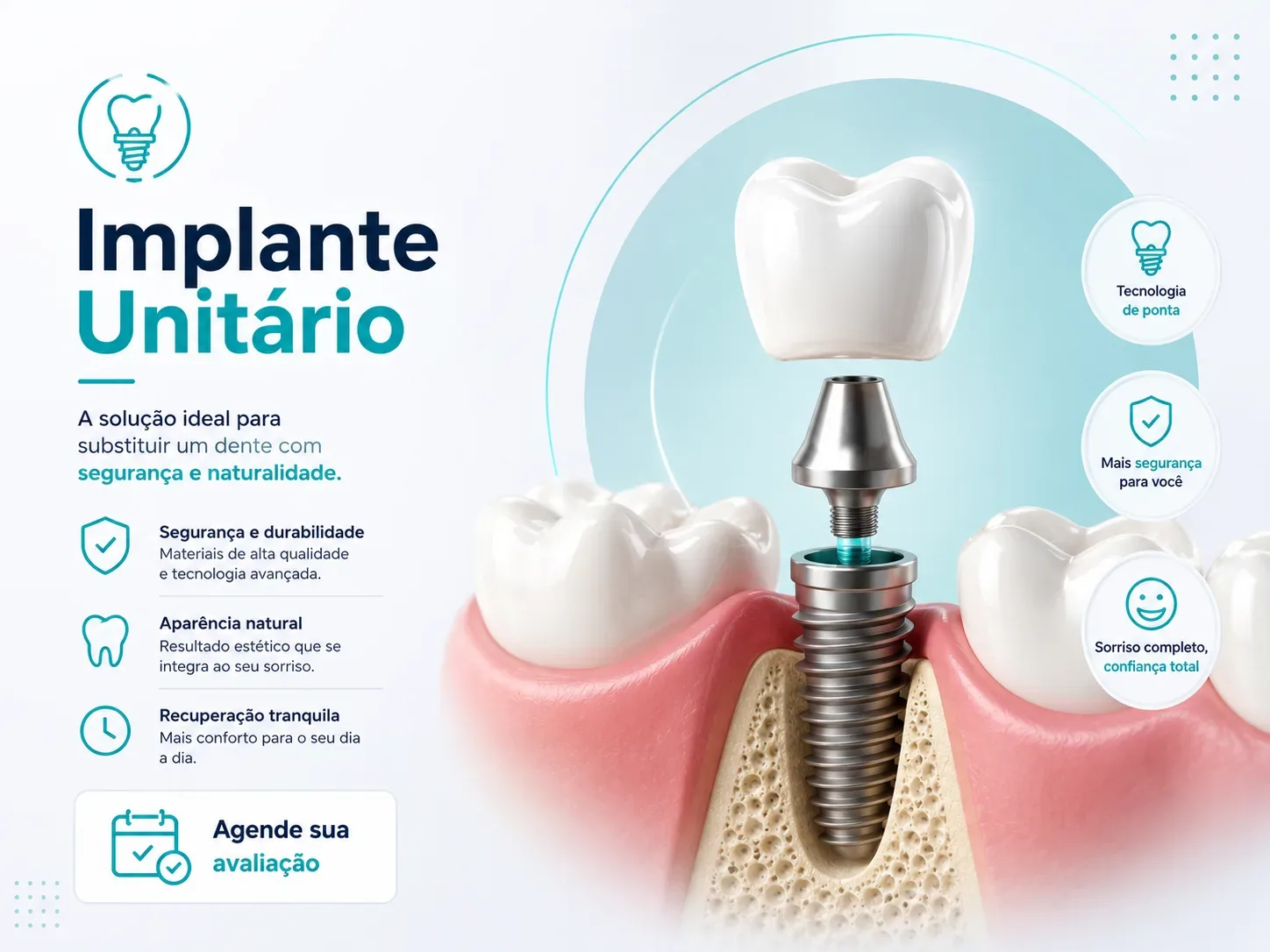 Implante Unitário