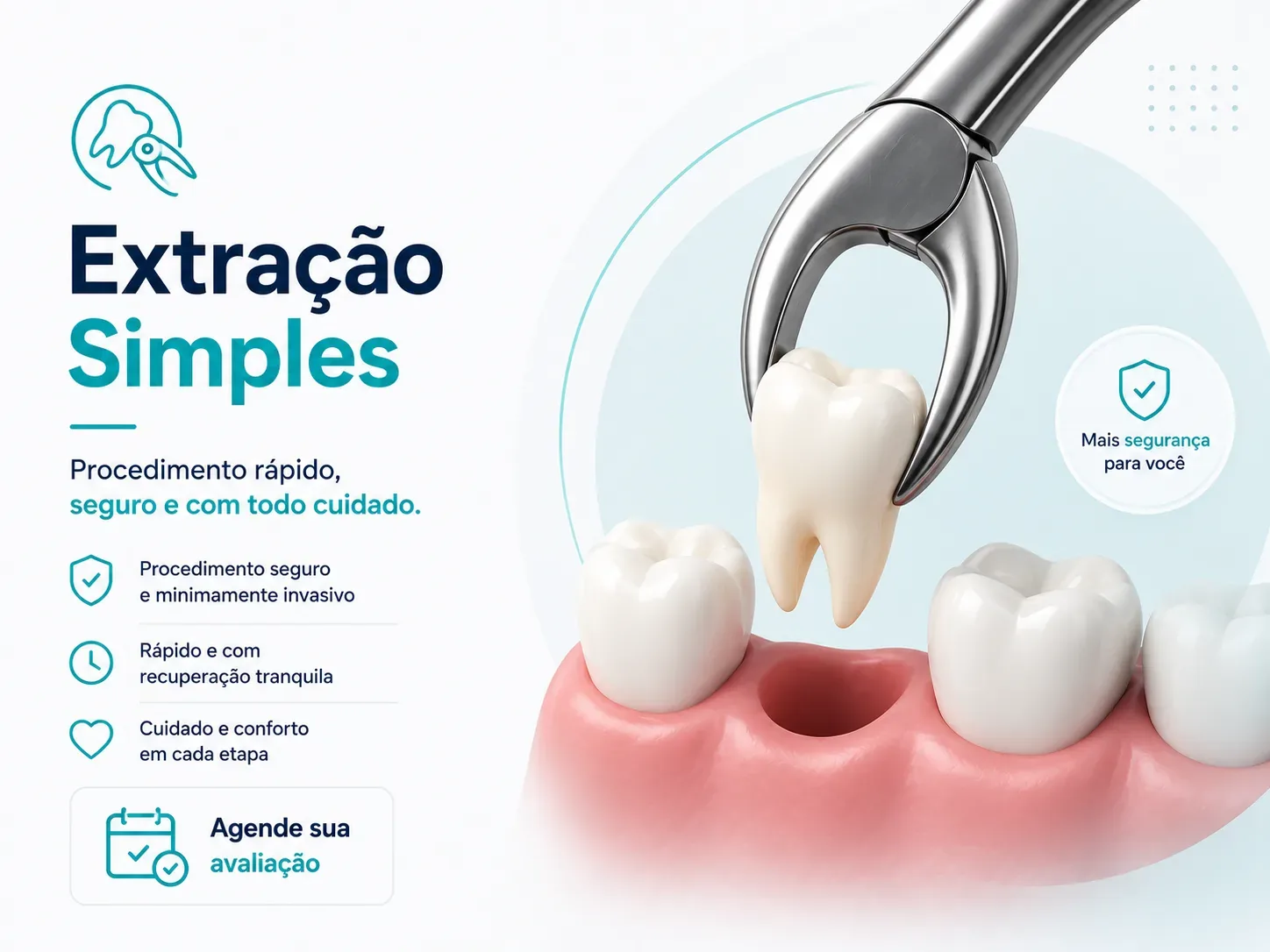 Extração Simples