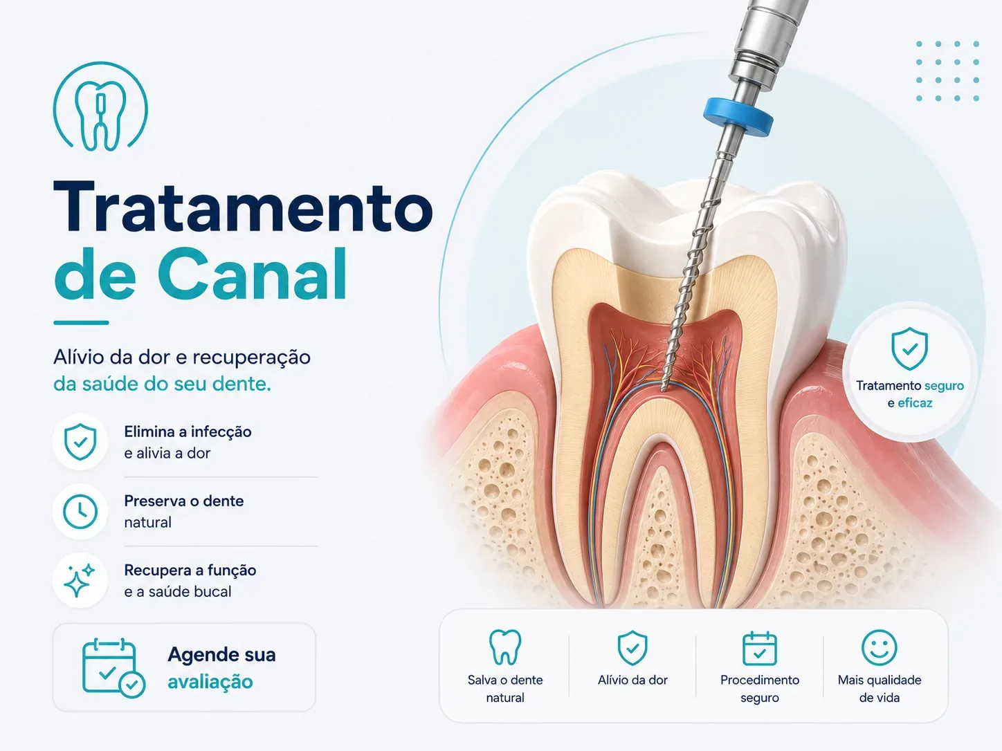 Tratamento de Canal